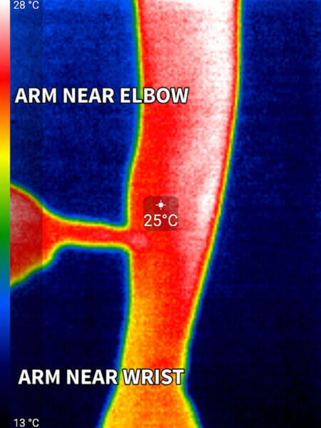 Arm vs elbow heat