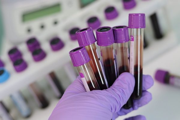lab blood samples